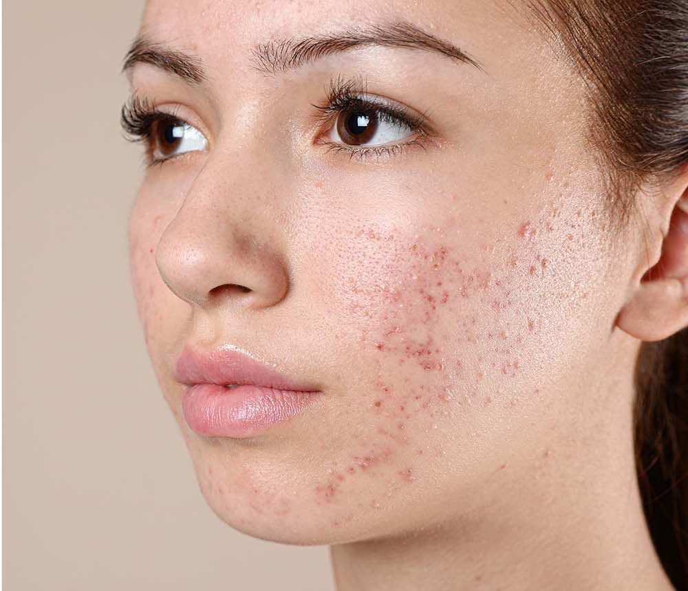 beforafter-e1643835811970