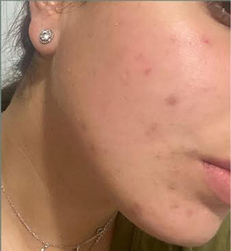 After_model_2_WEB800