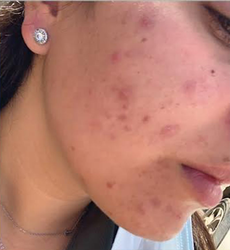 Before_model_2_WEB800